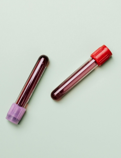 Kaks täis vere kogumistoru lebavad rohekal taustal.